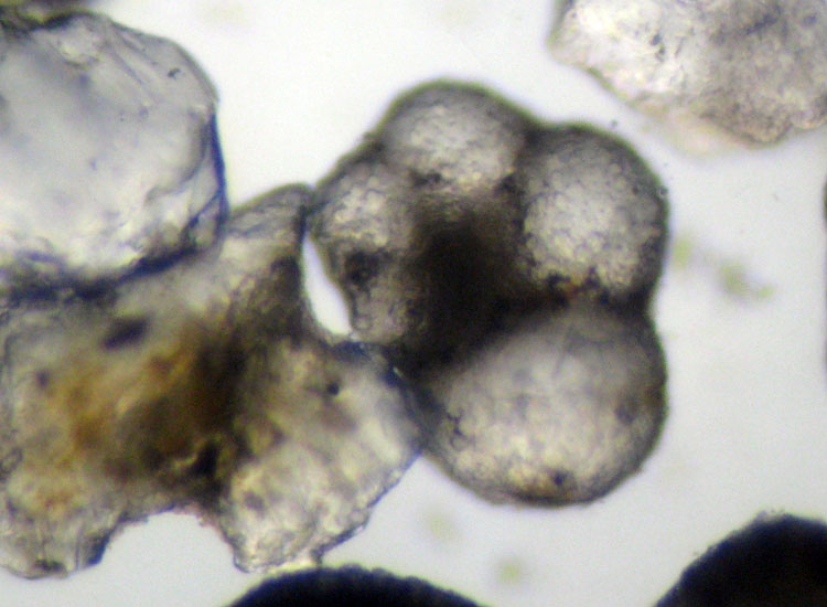 Microfossili o microconchiglie?